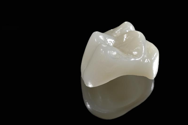 Porcelain Crowns  Manhattan, MT